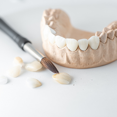 Dental crowns, brush, and model of teeth