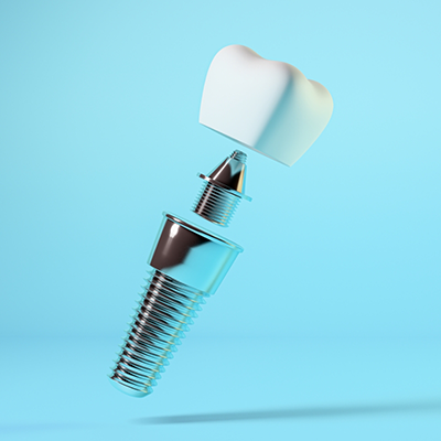 Crown, abutment, and dental implant in River Ridge