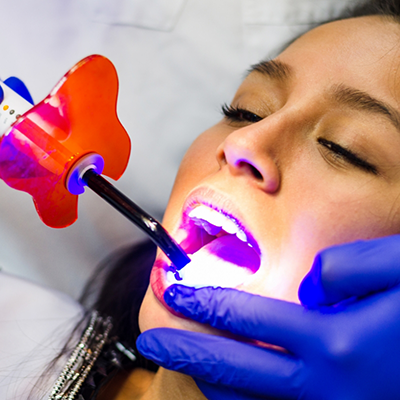 Dental patient having cosmetic dental bonding performed