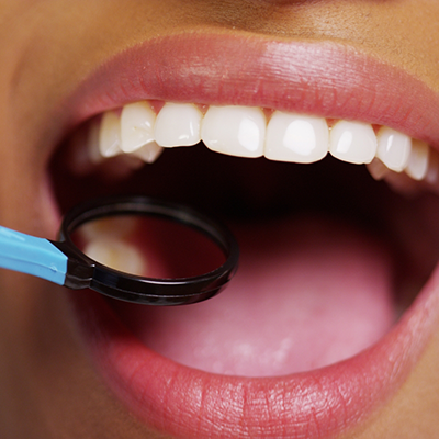 Close up of mouth and dental mirror